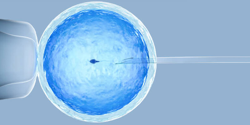 Infertility treatment doctor in Colaba - Dr. Aditi Pophale